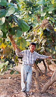 Medical Penis Enlargement